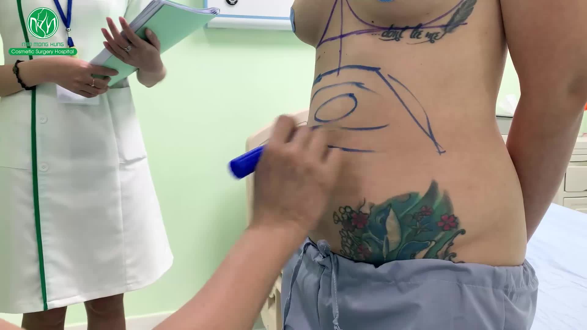 Ca phẫu thuật sáng nay tại Bệnh viện Thẩm mỹ Ngô Mộng Hùng giúp chị khách sở hữu ngay