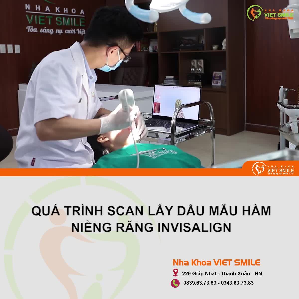 Cận cảnh Scan 3D lấy dấu hàm - Niềng răng invisalign tại Nha khoa VIET SMILE