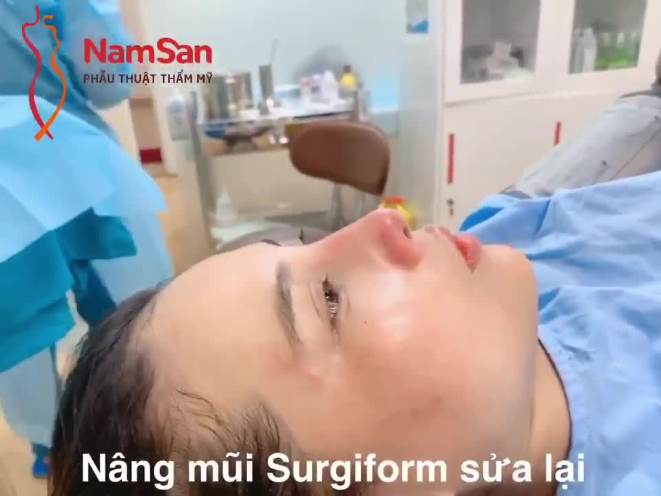 NÂNG MŨI SỬA LẠI