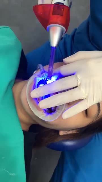 Những chia sẻ của BS Hoà về tình trạng răng của bệnh nhân