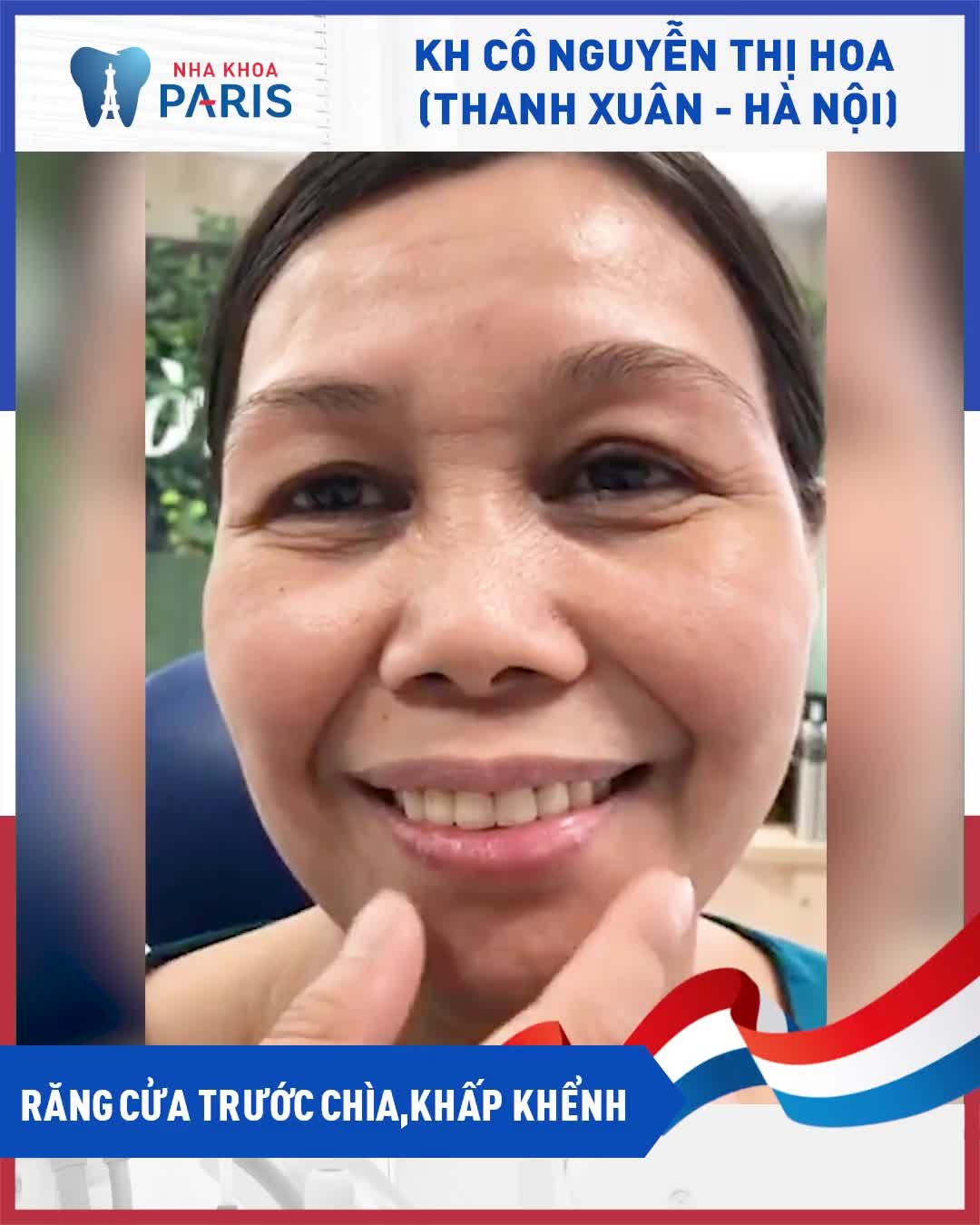 Răng Khấp Khểnh - Chìa Ra Ngoài - Ăn Nhai Khó - Kém Thẩm Mỹ‼