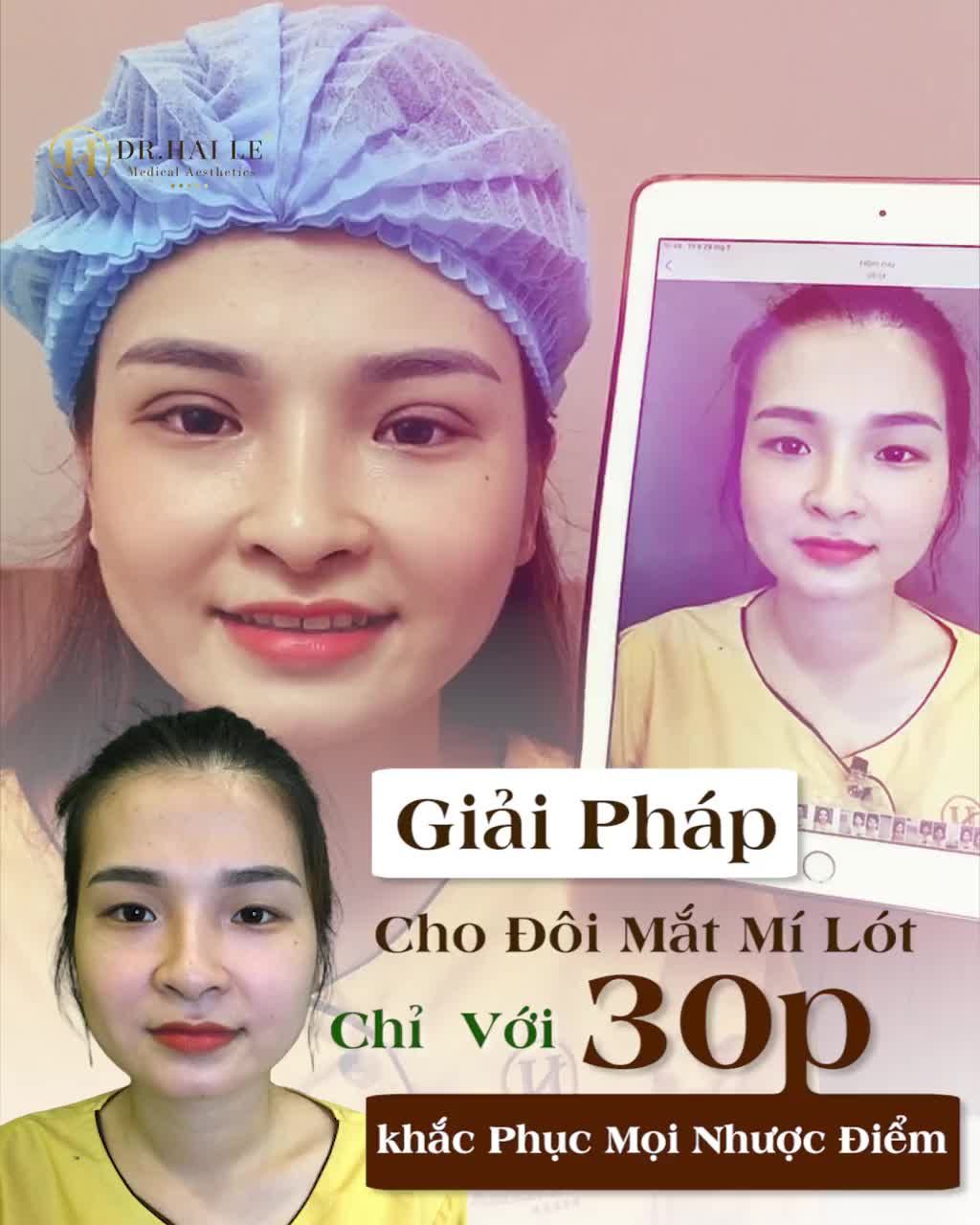 Đừng để đến khi soi gương cũng cảm thấy tự ti vì “đôi mắt” chưa đẹp!