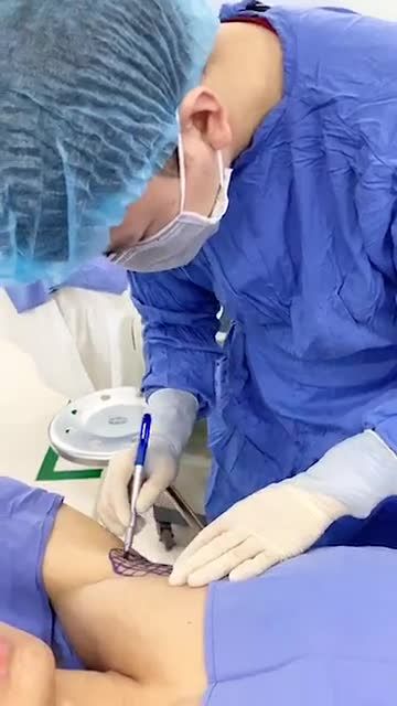 Quy trình Điều trị hôi nách ENDO DRY