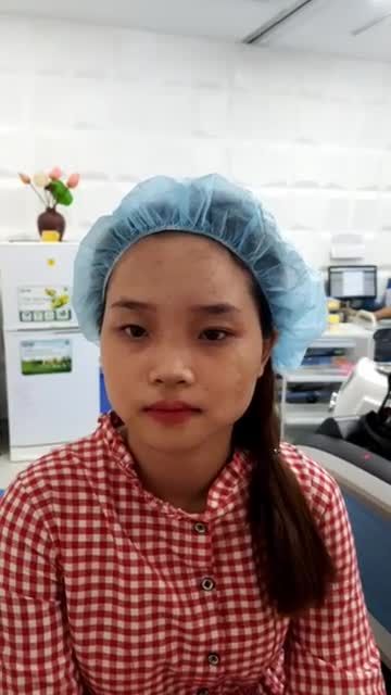 Laser Picosure - Số 1 về điều trị bớt sắc tố tại Bệnh viện thẩm mỹ Kangnam