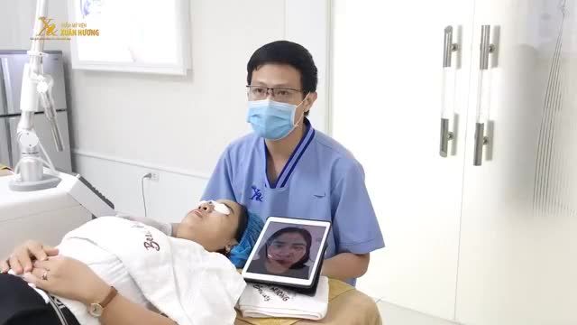 NÁM + TÀN NHANG ĐEN KÍN MẶT MỜ TỚI 80% CHỈ SAU 01 BUỔI ĐẦU TIÊN