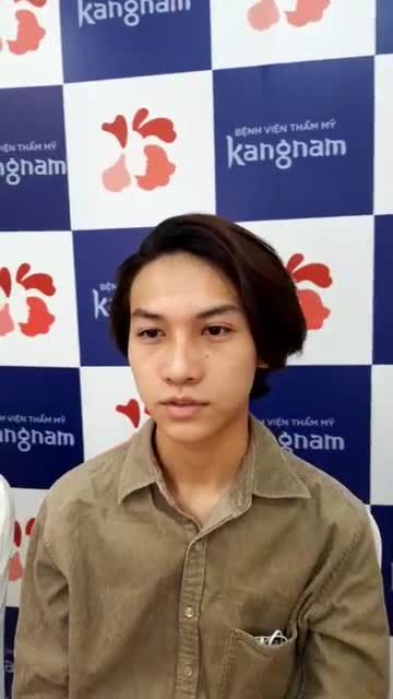 "Lột xác" thành Nam thần sau 10 ngày Nâng mũi cấu trúc 4D + Cuộn cánh mũi