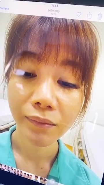 CA MŨI SỤN SƯỜN CHO KHÁCH HÀNG ĐÃ SỬA MŨI HỎNG 3 LẦN Ở HÀN QUỐC