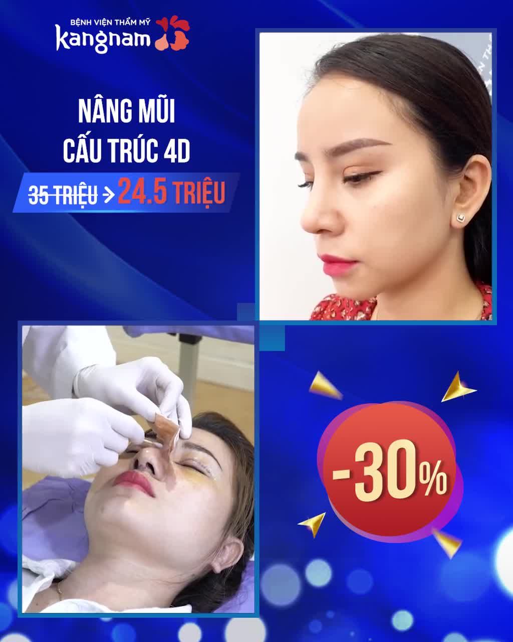 Chính thức mở TUẦN VÀNG NÂNG MŨI