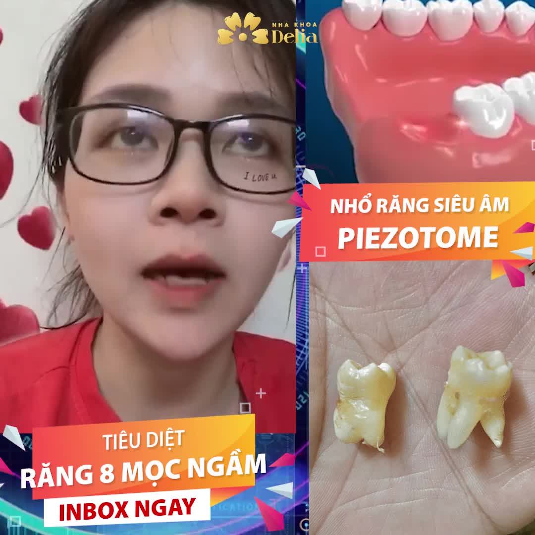 Feeback cực xịn đến từ khách hàng sau khi nhổ răng khôn tại Delia