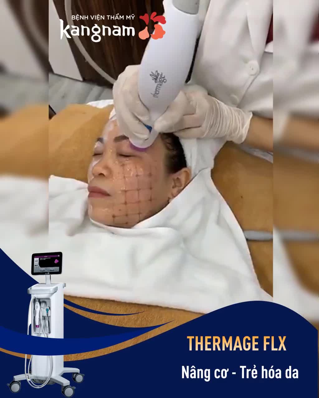 Công nghệ Thermage FLX hiện đại nhất