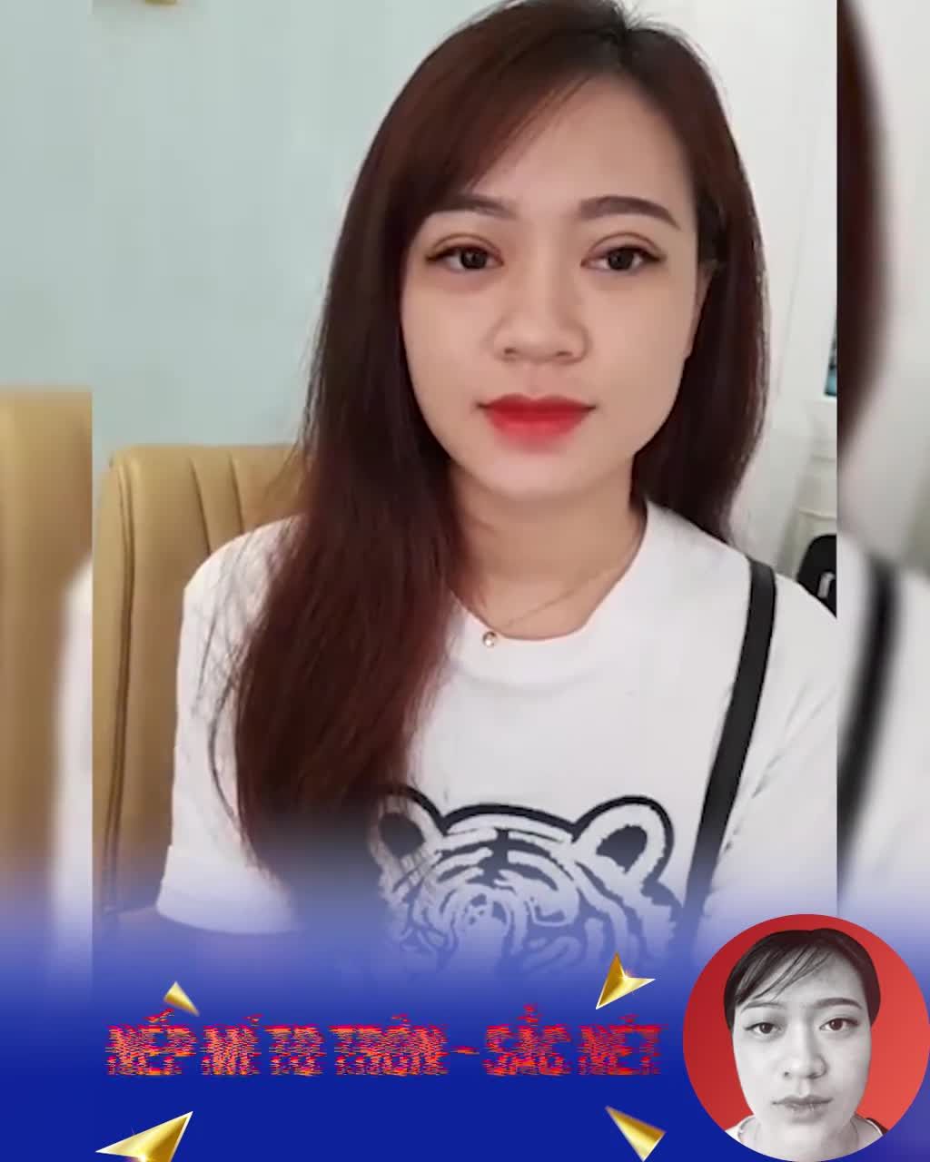 Duy nhất Tuần Vàng THẨM MỸ MẮT tiết kiệm 6.2TR