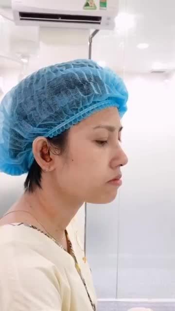 NÂNG MŨI CẤU TRÚC SỤN SURGIFORM CHƯA BAO GIỜ HẾT HOT TẠI DR.HOẠT