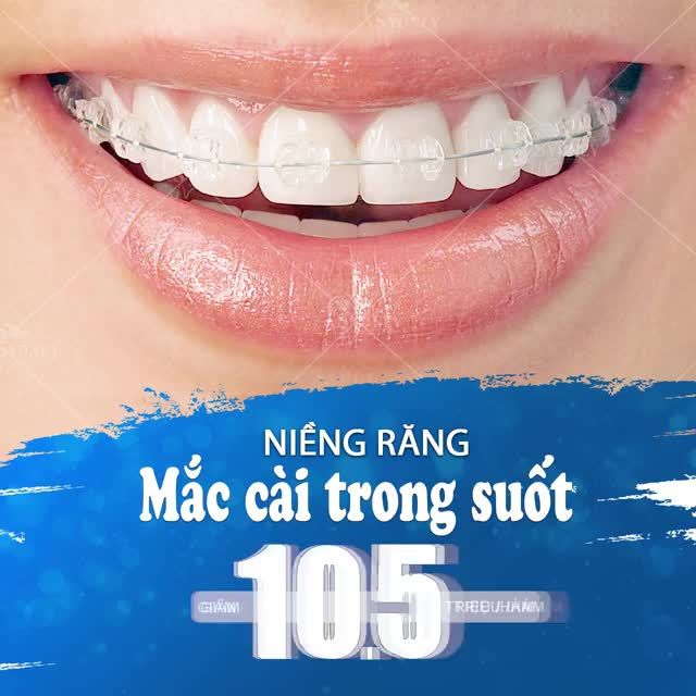 NIỀNG RĂNG PHA LÊ TRONG SUỐT - TỰ TIN CƯỜI CUỐN HÚT