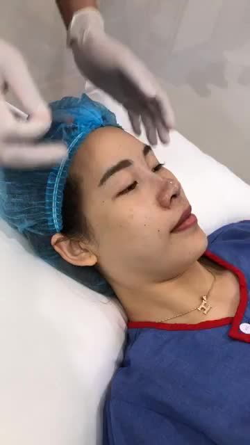 "TẬN MẮT" Xem bác sĩ thực hiện các bước nẹp mũi sau khi nâng cho khách hàng.