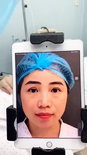 MŨI CẤU TRÚC SẼ XỬ LÝ KHUYẾT ĐIỂM NHƯ THẾ NÀO?