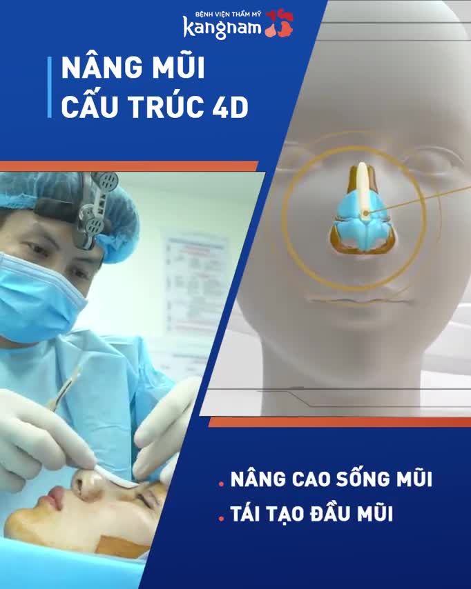 NÂNG MŨI CẤU TRÚC 4D - NÂNG LÀ ĐẸP  chỉ 23.5TR
