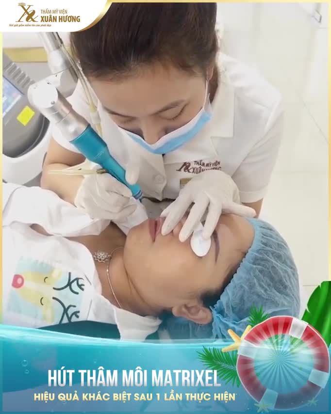 DÙNG SON CHỨA CHÌ LÂU NĂM, MÔI VỪA THÂM VỪA KHÔ TRẦM TRỌNG HÚT THÂM MÔI MATRIXELL, MÔI HỒNG HÀO CHỈ SAU 1 LẦN THỰC HIỆN