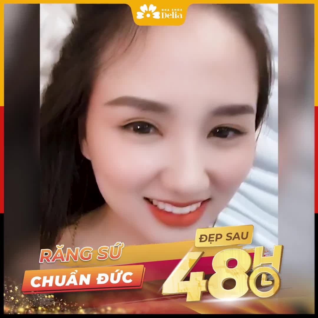 Răng nhiễm màu, ố vàng Răng khấp khểnh, hình thể xấu Răng thưa, vỡ mẻ Răng hỏng do làm sứ kém chất lượng, phủ sứ nano