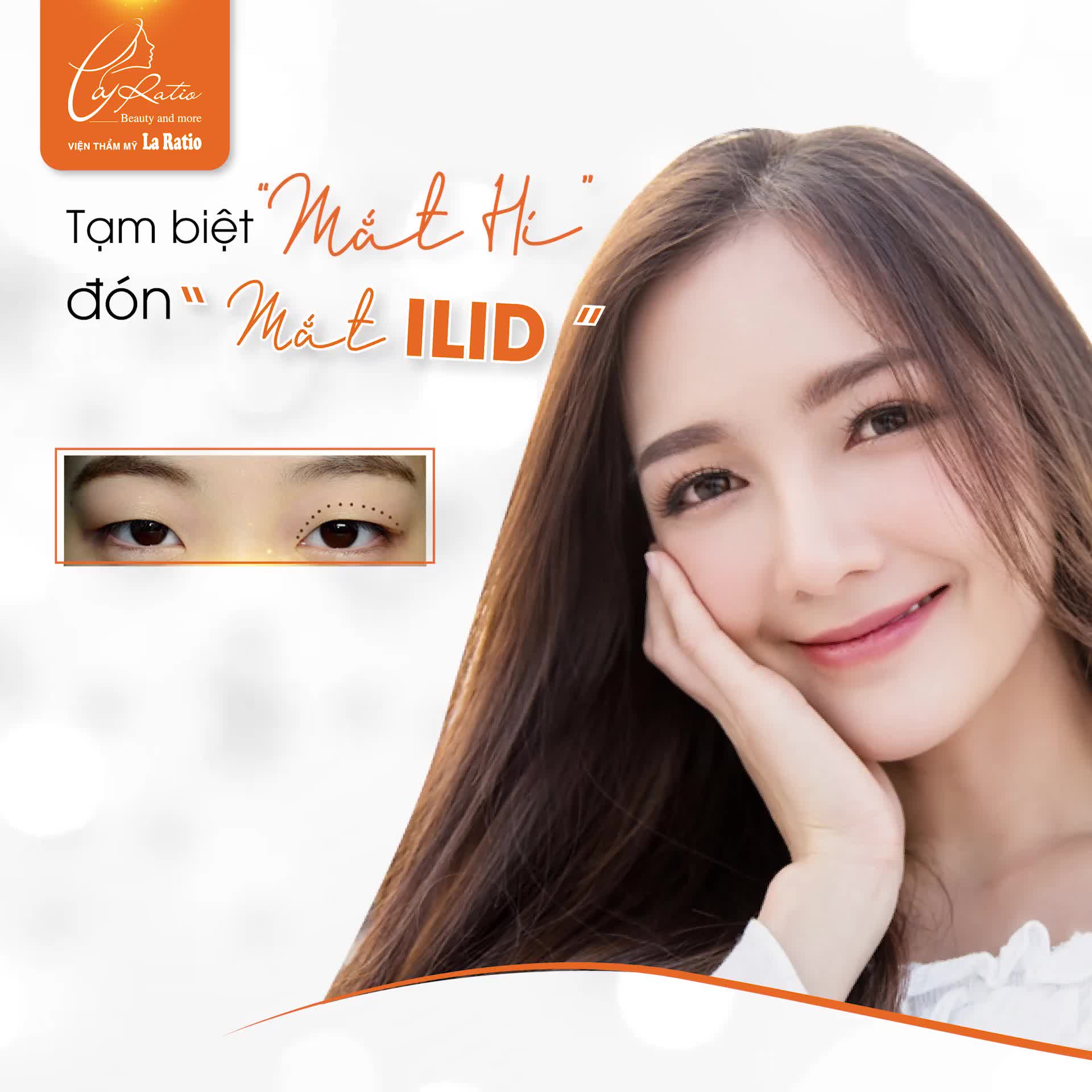 TẠM BIỆT MẮT "HÍ" CHỈ SAU 4 NGÀY