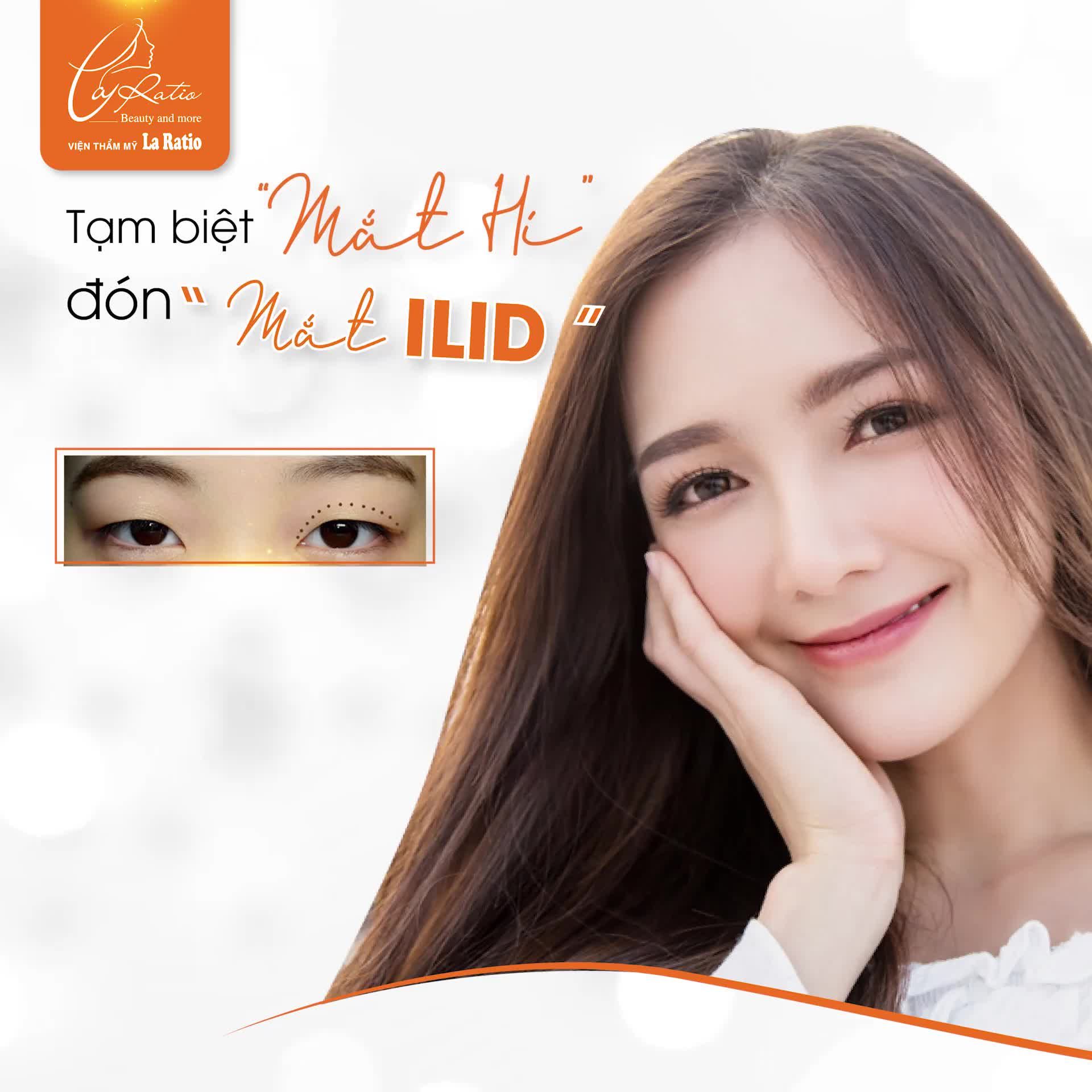 TẠM BIỆT MẮT "HÍ" CHỈ SAU 4 NGÀY