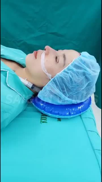 Nâng mũi Cấu Trúc Fascia tặng bấm mí muti deep
