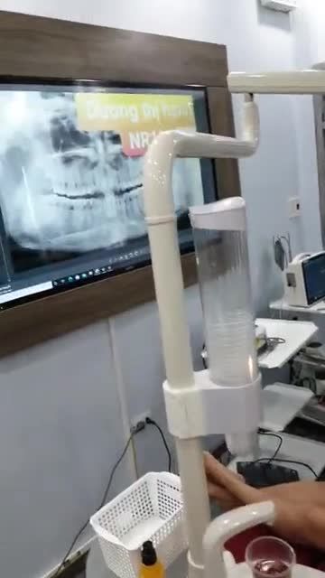 Ca nhổ răng khôn hàm trên R18.