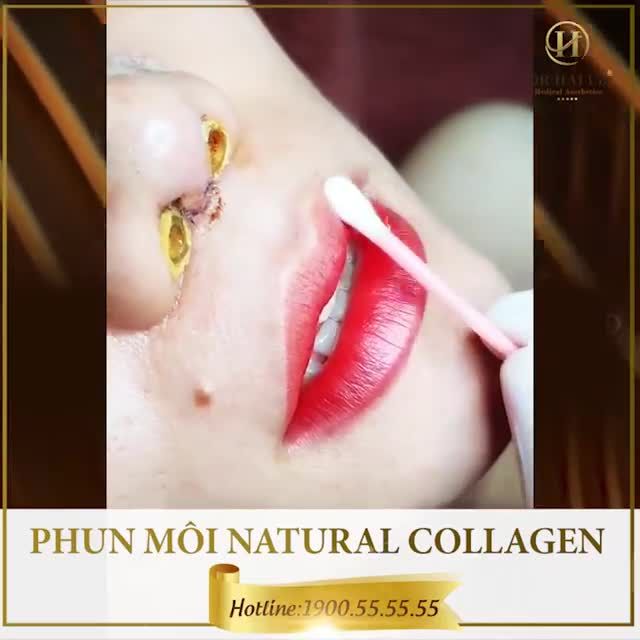 Người phụ nữ có một điều không bao giờ nên bỏ lỡ đó chính là làm môi, bởi đôi môi luôn là điểm nhấn và thu hút nhất trên khuôn mặt