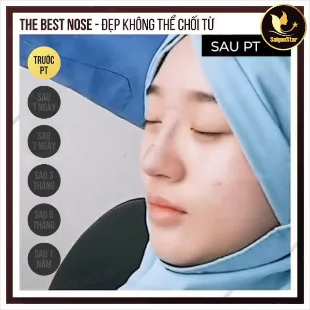 THE BEST NOSE - ĐẸP KHÔNG THỂ CHỐI TỪ