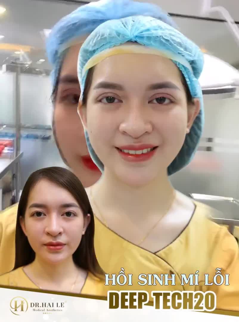 "HỒI SINH" MÍ XẤU HỎNG TẠI VTM DR.HẢI LÊ - ĐẸP VÀ ĐẸP HƠN NỮA!