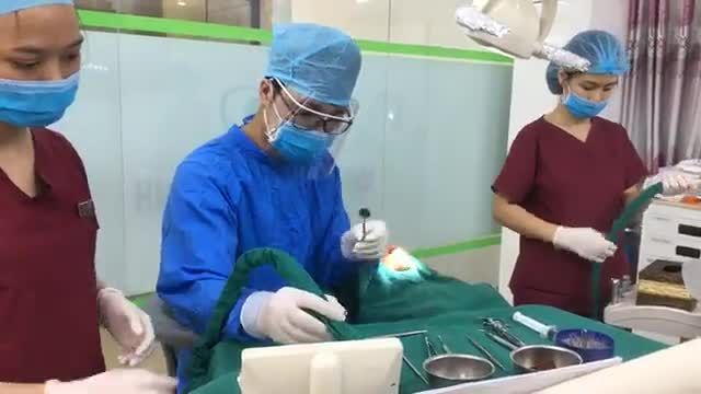 Cấy implant r16 cho khách hàng tại Nha Khoa Thuỳ Anh.