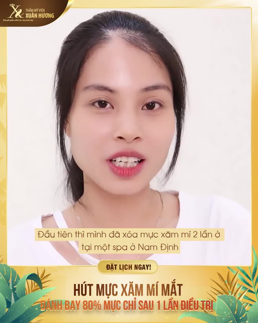MỰC XĂM MÍ LÂU NĂM PHAI MÀU XANH LẪN TRẮNG