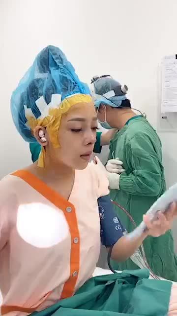 Khách hàng sóng mũi thấp, đầu mũi ngắn hếch, nền xương không đều. Khách hàng đã sử dụng phương pháp cấu trúc sụn tai. Dáng mũi Sline cao tây