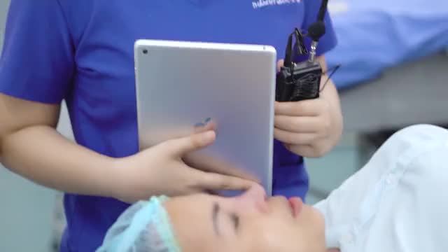 KẾT QUẢ CA SỬA MŨI LỆCH SỐNG, LỘ SỐNG VÀ BÓNG ĐỎ