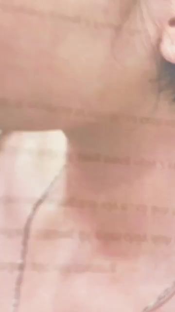 MŨI CẤU TRÚC KHẮC PHỤC TÌNH TRẠNG MŨI NGẮN - ĐẦU MŨI TO - SÓNG MŨI GÃY GỒ