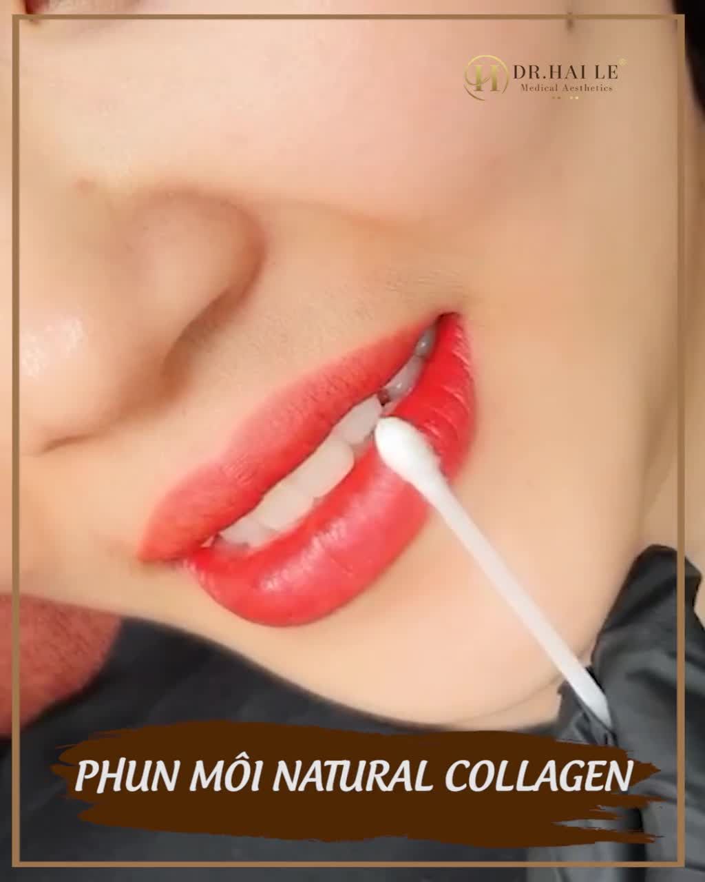 TẠI SAO PHUN MÔI NATURAL COLLAGEN LẠI HOT ĐẾN NHƯ VẬY
