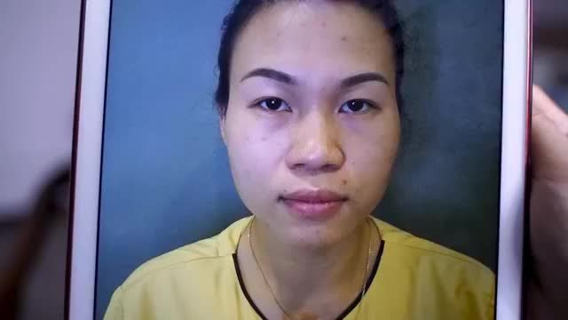 Mắt sụp mí khiến mẹ bỉm sữa già hơn so với tuổi thật. Quyết định Cắt mí có phải là lựa chọn đúng?. XEM NGAY TẠI ĐÂY NHÉ!