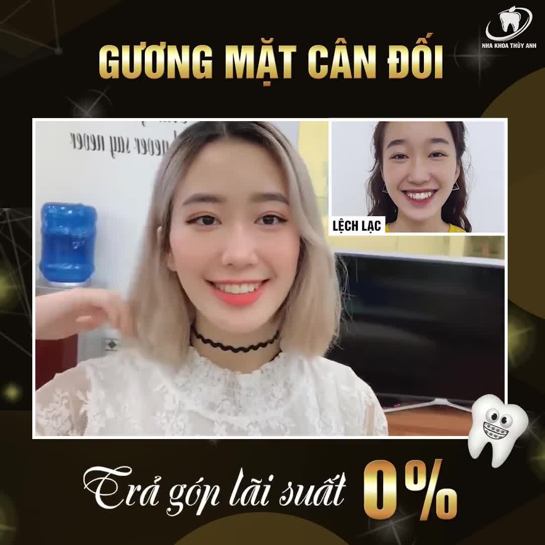 RĂNG HÔ, THƯA, MÓM, KHẤP KHỂNH, LỆCH LẠC