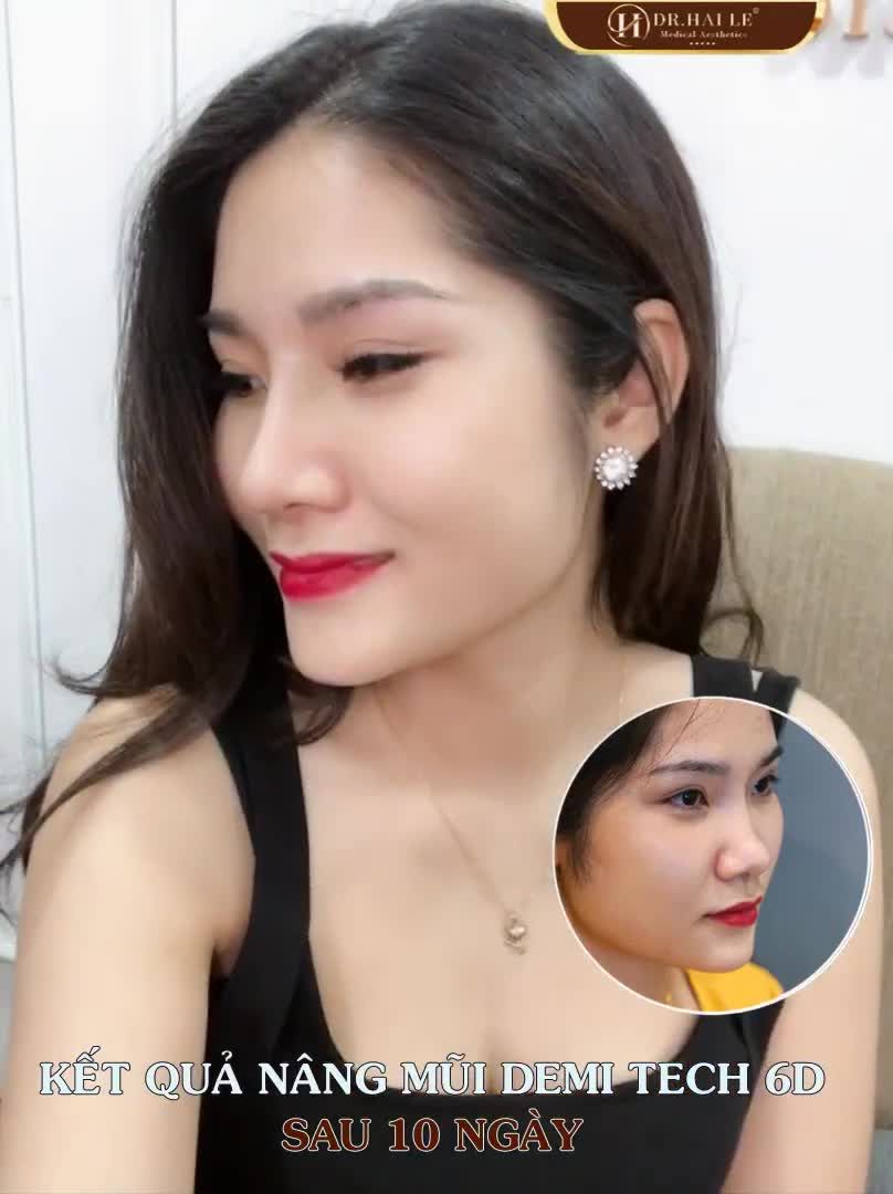 CHIA TAY MŨI XẤU - SỞ HỮU DÁNG MŨI THANH TÚ CHỈ SAU 45 PHÚT ‼️