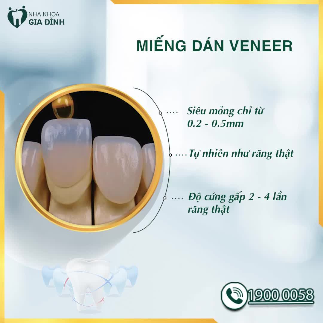 DÁN SỨ VENEER SIÊU MỎNG - HƠN 10.000 KHÁCH HÀNG ĐÃ LỰA CHỌN