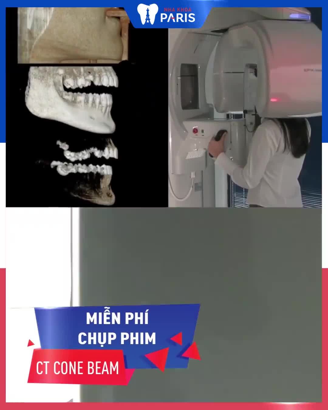 RĂNG GÃY RỤNG CẢ HÀM - TIÊU XƯƠNG - ĂN NHAI KÉM