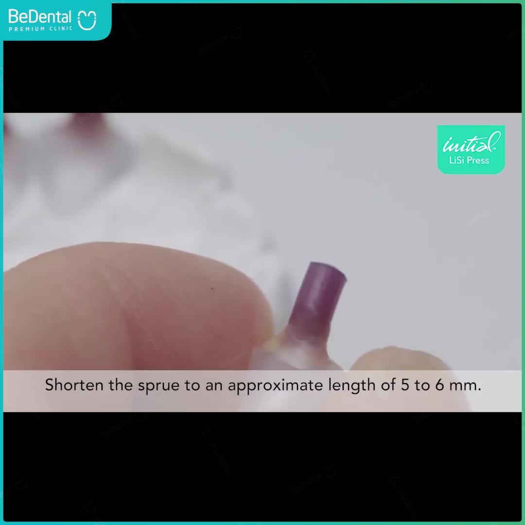 RĂNG SỨ LISI PRESS - "ĐẸP TỪ TRONG TRỨNG"