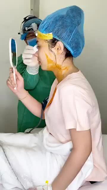 "TƯƠI RÓI" SAU NÂNG MŨI VÌ QUÁ XINH ĐẸP