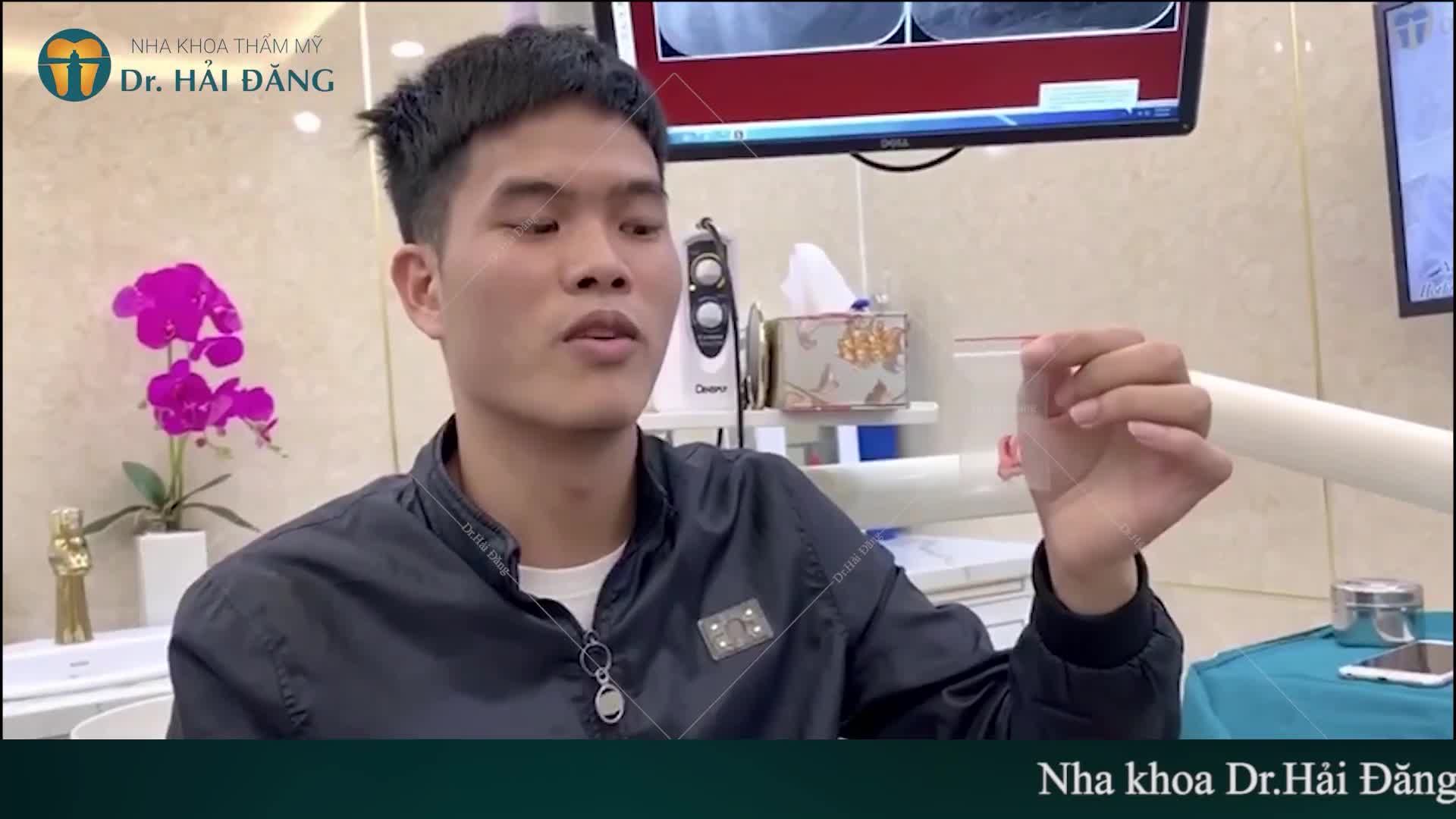 RĂNG KHÔN CÓ THỰC SỰ KHÔN