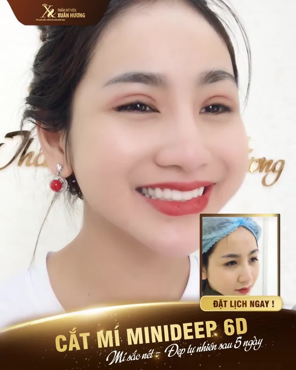 CHỈ SAU 5 NGÀY - CÓ NGAY NẾP MÍ SẮC NÉT ĐẸP TỰ NHIÊN DUY NHẤT CHỈ CÓ TẠI TMV XUÂN HƯƠNG