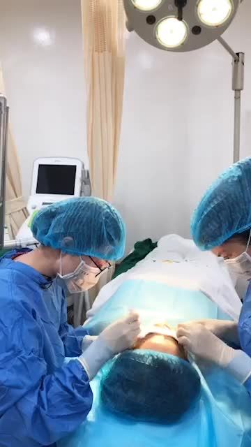 Lấp đầy sẹo LÕM/RỖ chỉ sau 60 phút