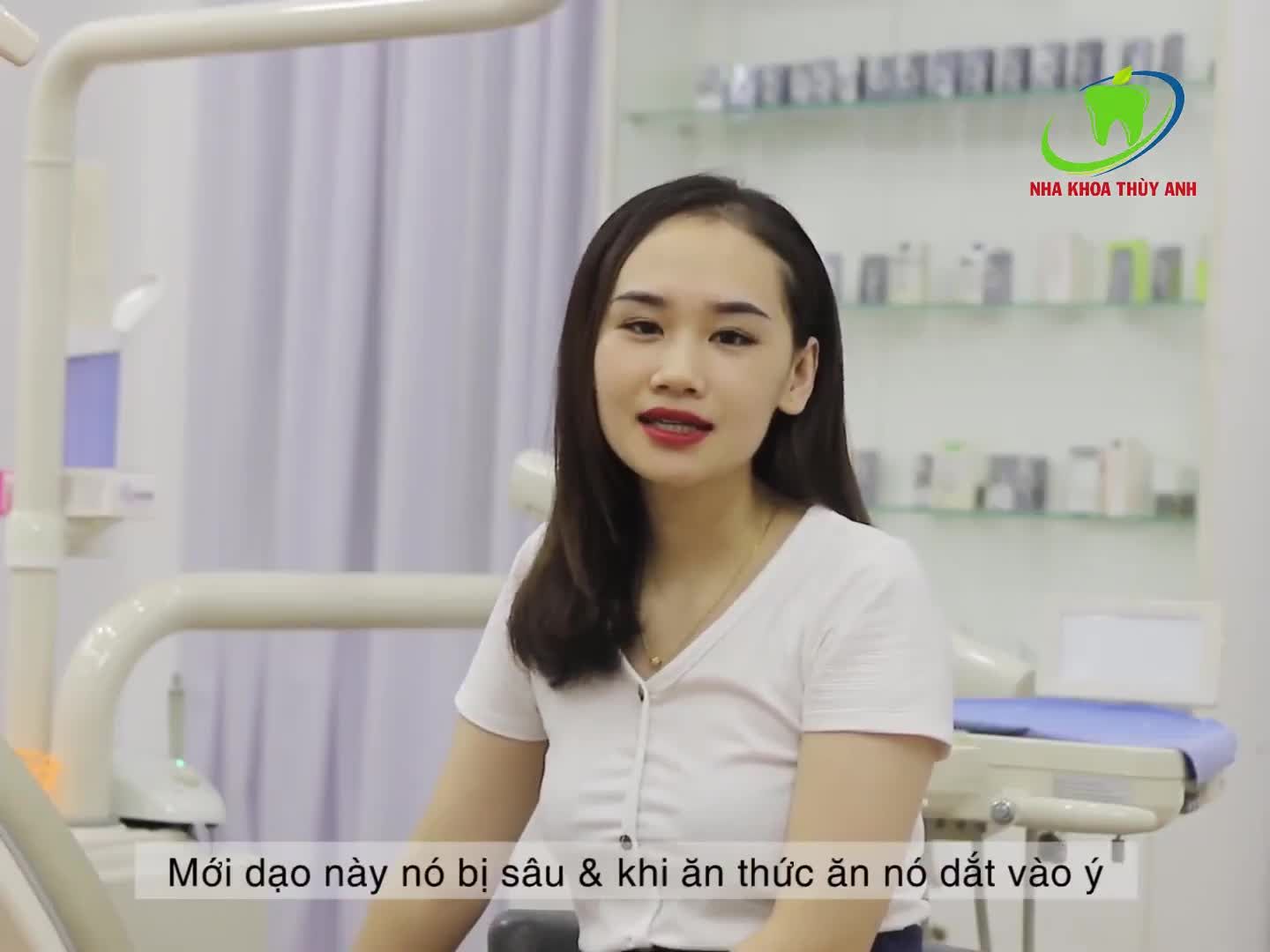 Răng khôn (răng số tám hay răng hàm lớn thứ ba) là răng mọc cuối cùng, thông thường ở người trong độ tuổi từ 17 đến 25.