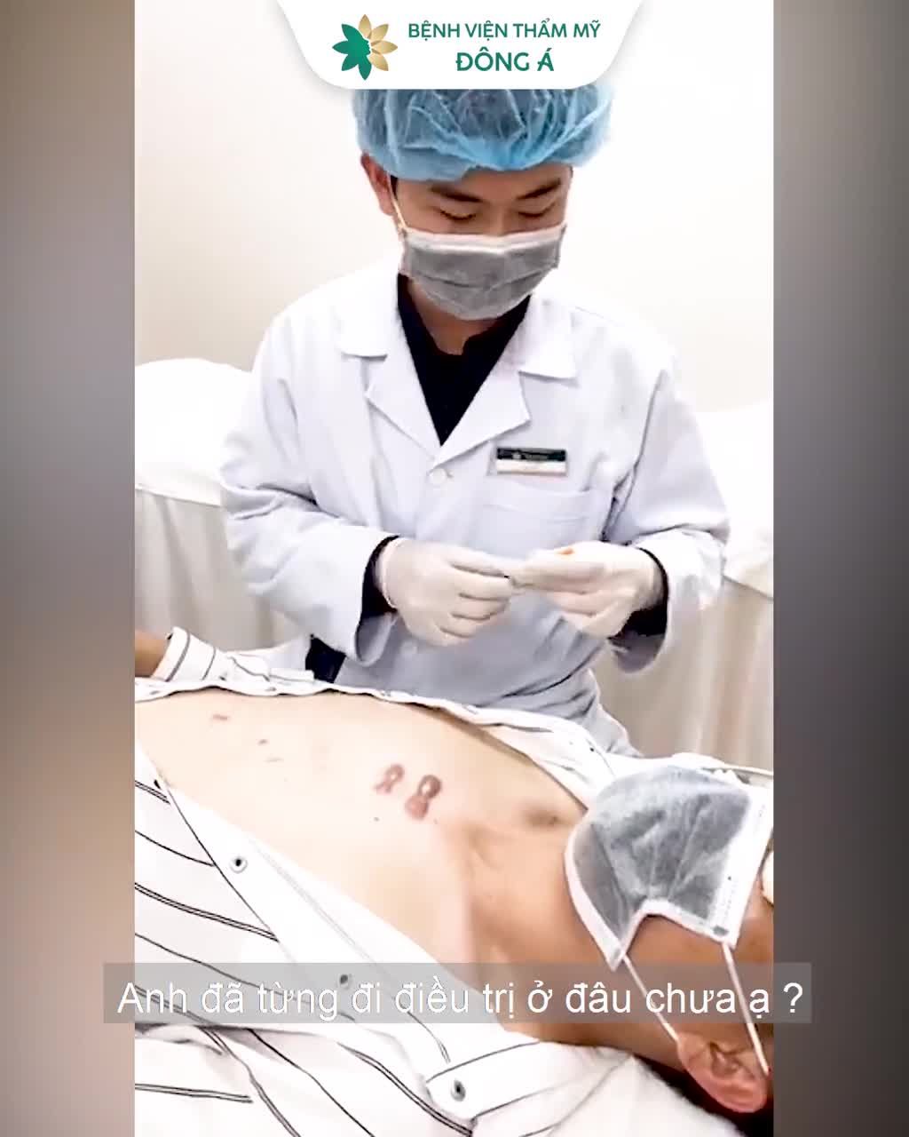 SẸO LỒI LÂU NĂM ĐAU, NGỨA - Chỉ vài nốt mụn trứng cá khiến anh T. A (30 tuổi) điên đầu