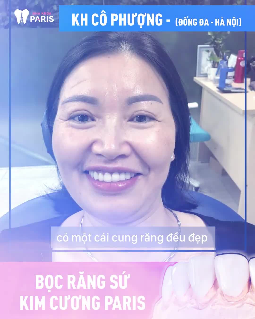 Kết Quả Sau 2 NGÀY - Bọc Răng Sứ Nano 5S