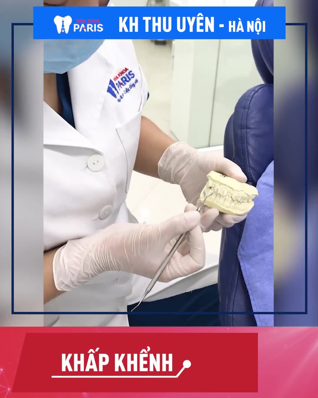 Tháo Niềng Sau Hơn 1 Năm Niềng Mắc Cài Kim Loại