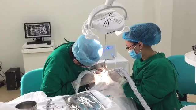 Bác sĩ VÕ LONG VÂN nhổ răng khôn mọc lệch